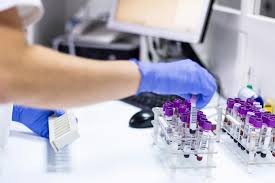 حالات تكون فيها نتائج تحليل سكري الدم التراكمي كاذبة