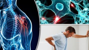 كيف يؤثر الطقس البارد على مرضى التصلب المتعدد؟