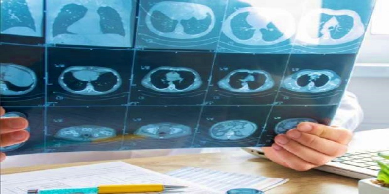 كيف يتم تشخيص ارتجاع صمام القلب؟