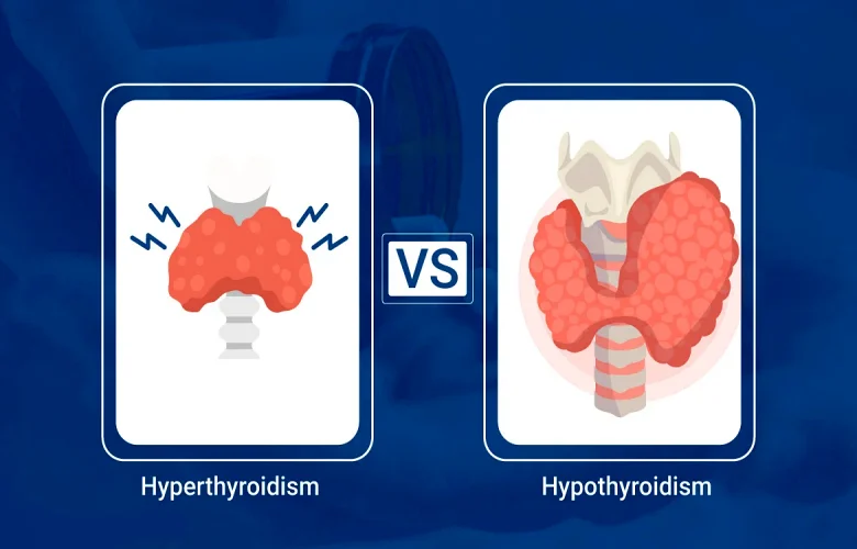 ما الفرق بين فرط نشاط الغدة الدرقية وقصور الغدة الدرقية؟