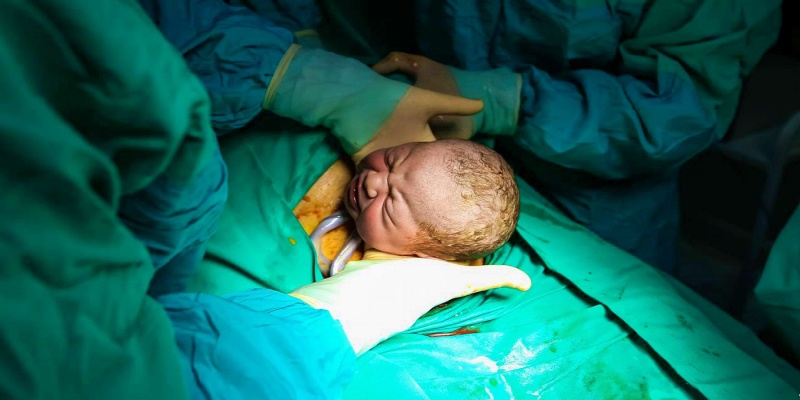 ما هي أفضل نصيحة طبية يجب تقديمها للأم وللطفل المولود قيصريا؟