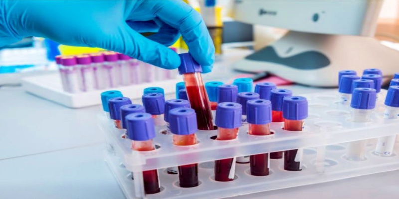 ما هي طرق اكتشاف الإصابة بمرض الزهري؟