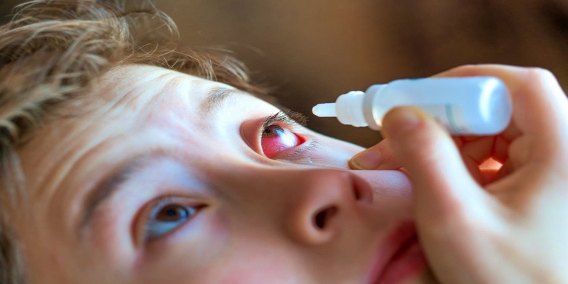 ما هي طرق علاج التهاب القزحية والعناية المناسبة بالعين؟