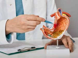 ماذا يعني ضعف صمام المعدة ؟