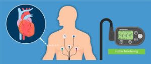 ماهي مميزات جهاز الهولتر ؟