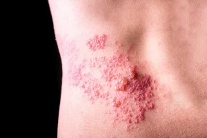 نبذة عن الحزام الناري