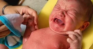 نصائح فعالة للأطفال مصابي التثدي الوليدي