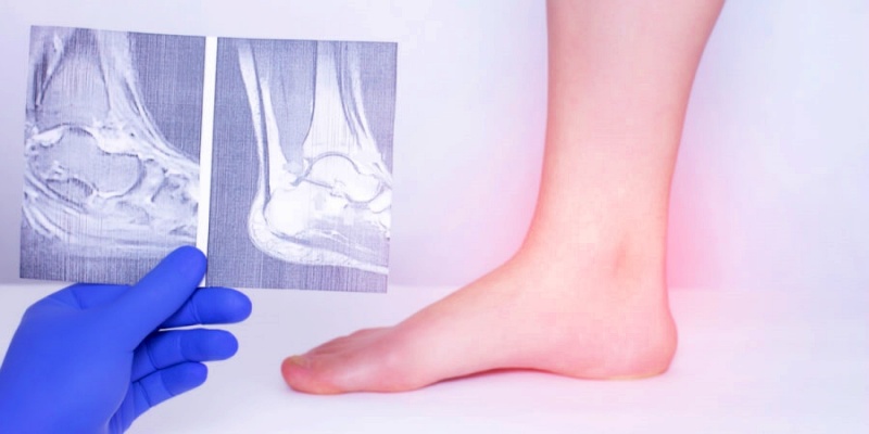 أسباب الاصابة بالتهاب المفاصل التفاعلي