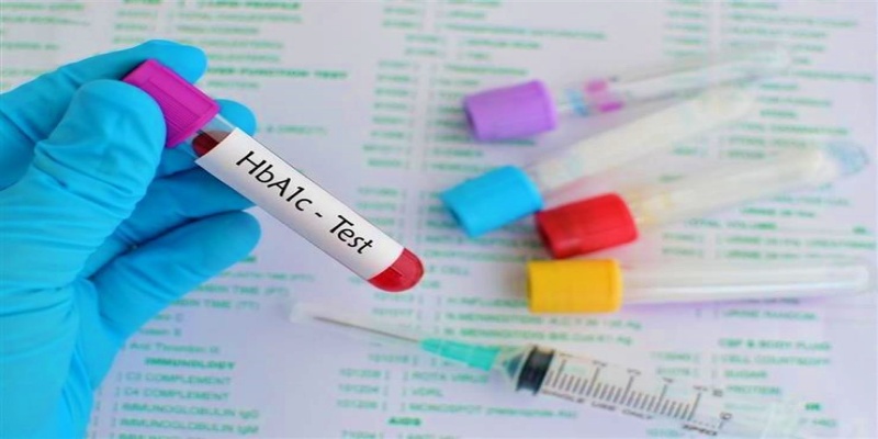 اختبارات الجلوكوز في الدم