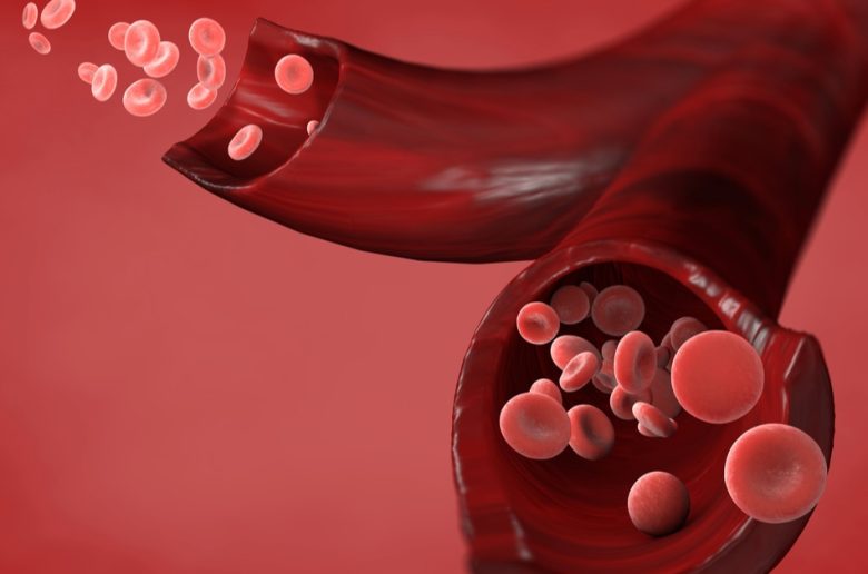 الأمراض التي تزيد من كرات الدم الحمراء