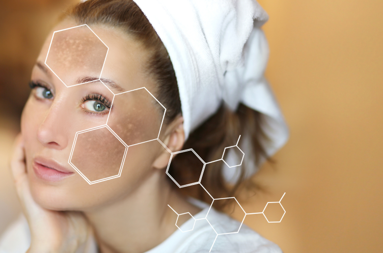 التصبغات الداكنة على الجبهة