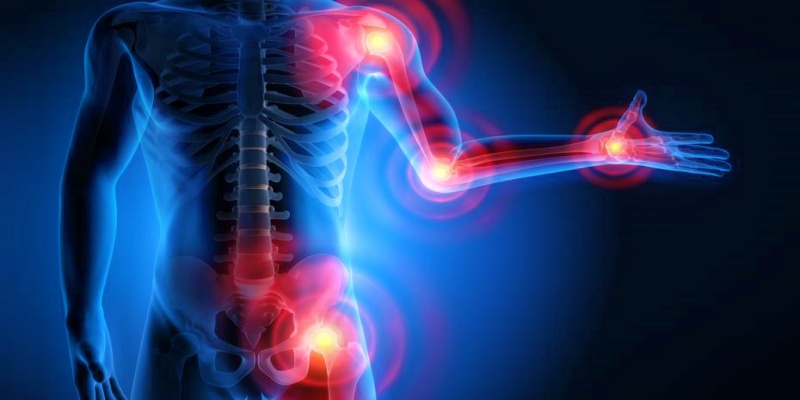 التهاب المفاصل التفاعلي