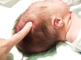 الفحص الإكلينكي