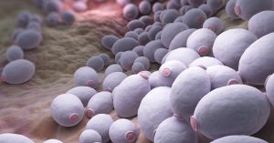 النمو المفرط لفطر الكانديدا