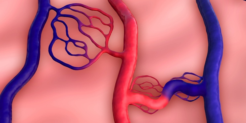 تشوهات الأوعية الدموية
