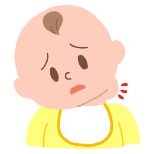 تضخم الغدد الليمفاوية&nbsp;