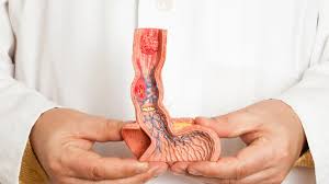 دوالي المرىء