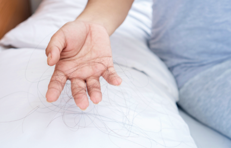 عادات النوم التي تؤدي إلى تساقط الشعر