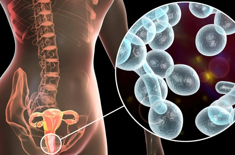 فوائد مكملات الزنك في مكافحة فطريات المهبل