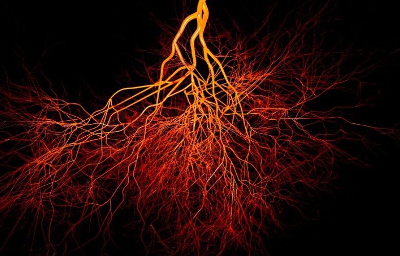 ما هي مخاطر الاصابة بتشوهات الأوعية الدموية؟