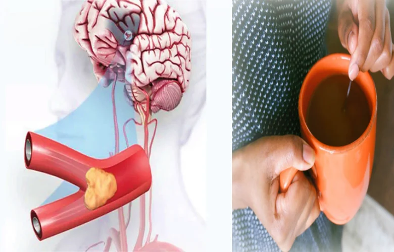 مشروبات طبيعية للحد من نقص التروية الدماغية