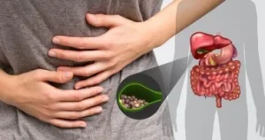 هل تعانين من الإمساك بعد عملية المرارة ؟