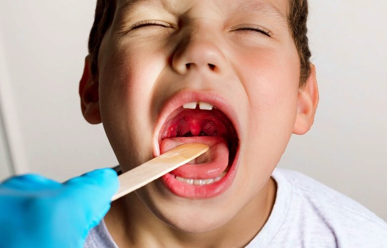 هل يجب إزالة اللوزتين مع اصابتهما بالالتهابات المتكررة؟