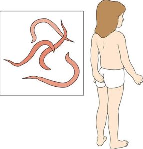 أسباب تدفع طفلك إلى حك منطقة الشرج