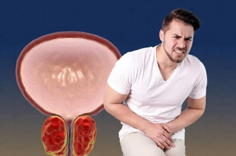 أشياء تؤثر سلبا على خطة التعافي من التهاب البروستاتا