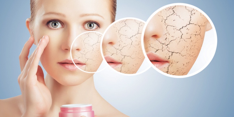 البشرة الجافة