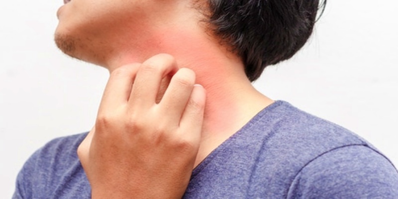 الحكة المستمرة وجفاف الجلد