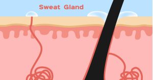 زيادة نشاط الغدد العرقية