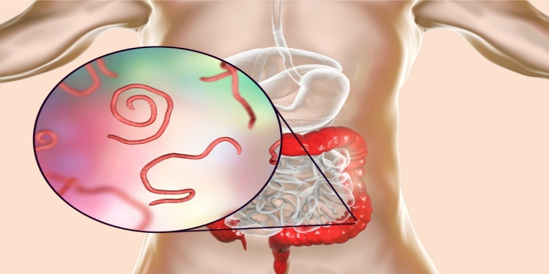 عدوى الدودة الطفيلية