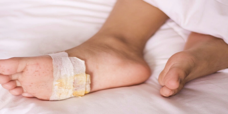 علامات الإنذار المبكرة لفقدان الإحساس بالقدم لدى مرضى السكري