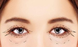 فترة التعافي