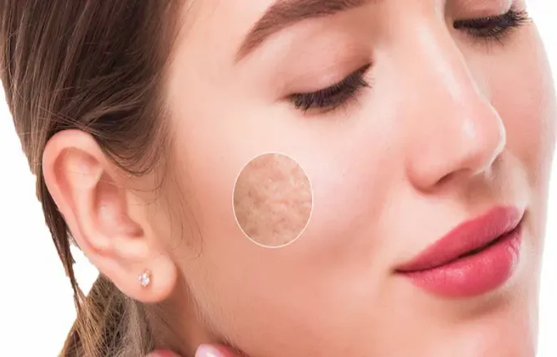 كيف نستطيع العناية بثقوب وندبات البشرة؟