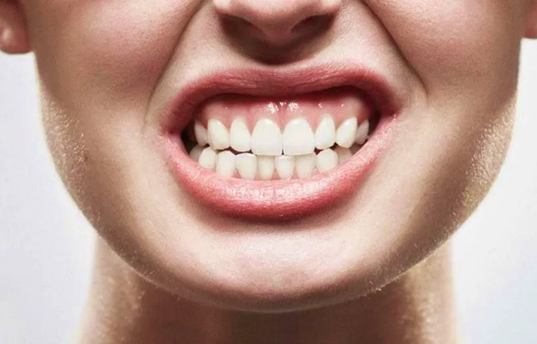 ما هي النتائج المترتبة على الاصابة بسوء إطباق الأسنان؟