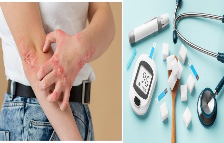 ما هي تأثيرات مرض السكري على صحة الجلد؟