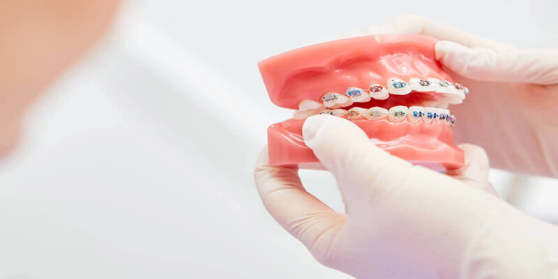 ما هي طرق علاج سوء إطباق الاسنان؟