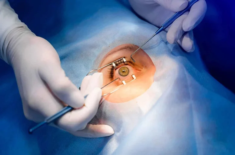 مضاعفات صحية تسببها جراحة المياة البيضاء