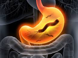 نبذة عن جرثومة المعدة