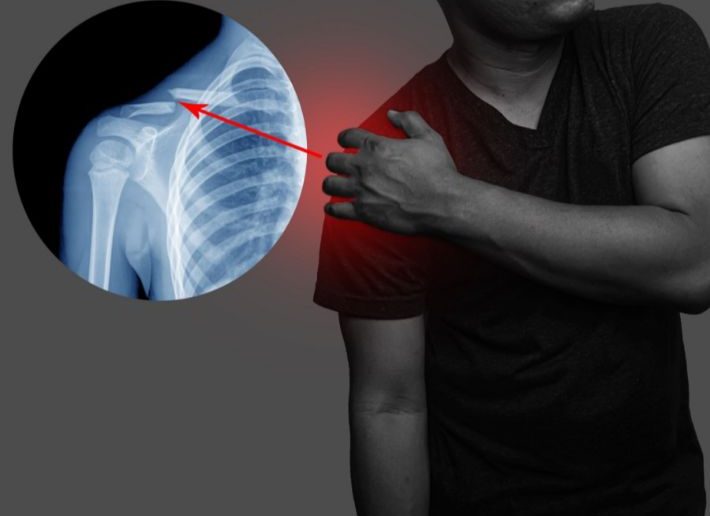 نقص الفيتامينات المؤدي إلى الشعور بالبرودة