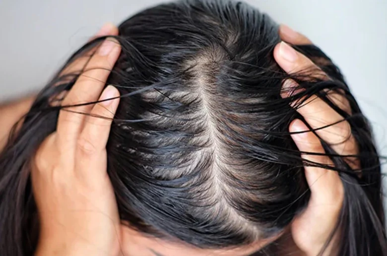 أفكار فعالة لإنتعاش الشعر الدهني