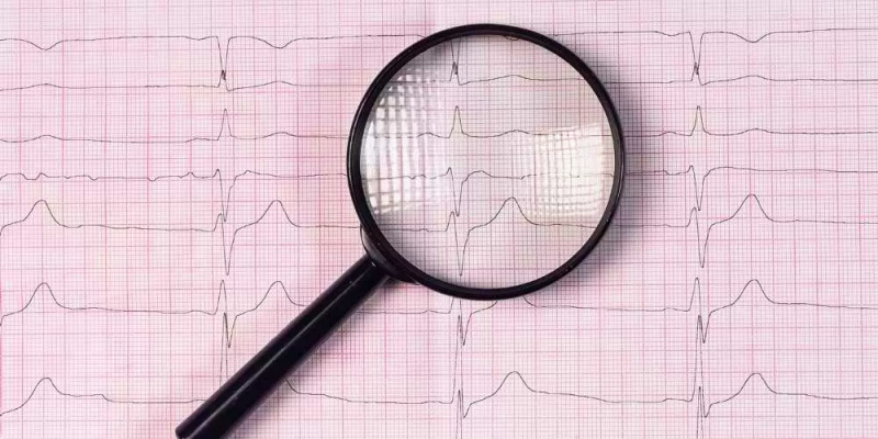 اضطرابات نظم القلب