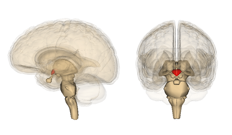 اعتلال الدماغ الفيرنيكي