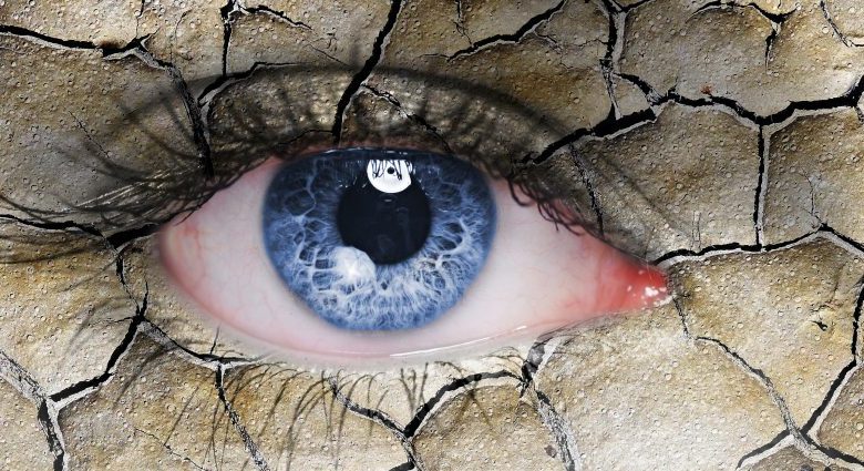 التدخل الجراحي لعلاج جفاف العين