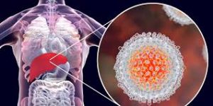 التهاب الكبد المزمن