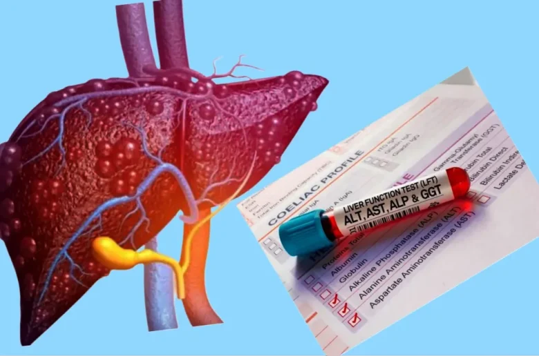 الحالات المرضية المؤدية إلى رفع إنزيمات الكبد