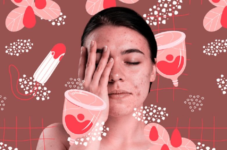 العناية بالشعر الدهني أثناء الدورة الشهرية