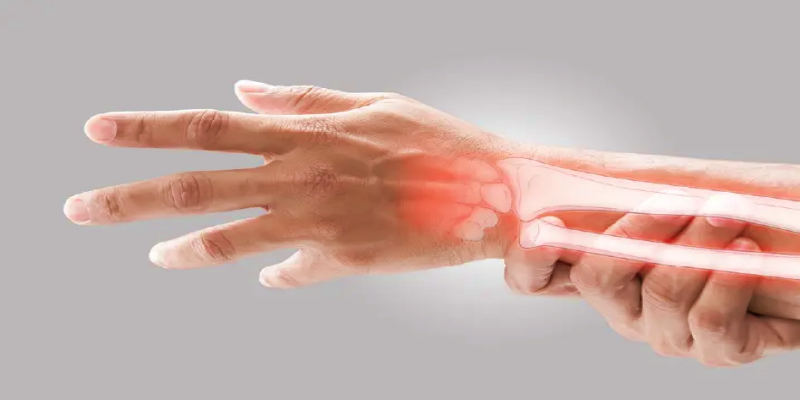 المعاناة من التهاب المفاصل العظمي